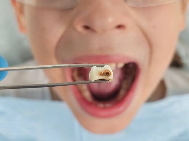 Best Emergency Gum Treatment in Seven Oaks, SC