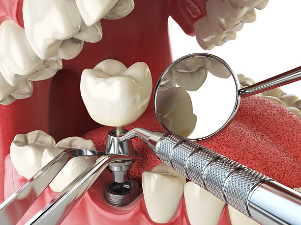Best Weekend Emergency Dentist in Seven Oaks, SC
