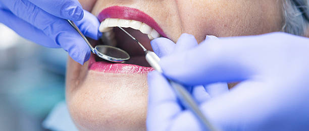 Best Emergency Dental Care for Broken or Chipped Teeth in Seven Oaks, SC